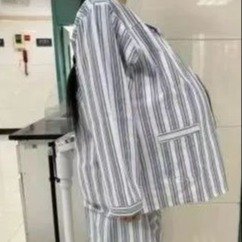 未婚女子腹部像孕妇意外瘦身68斤