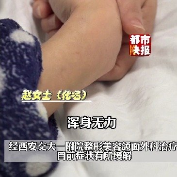 西安一女子为瘦脸打肉毒素中毒