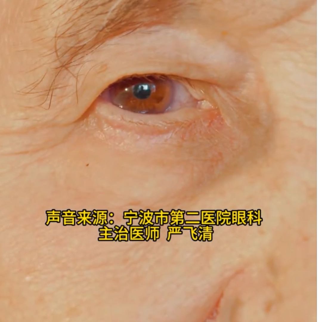 连吃1周感冒药瞳孔突然变大