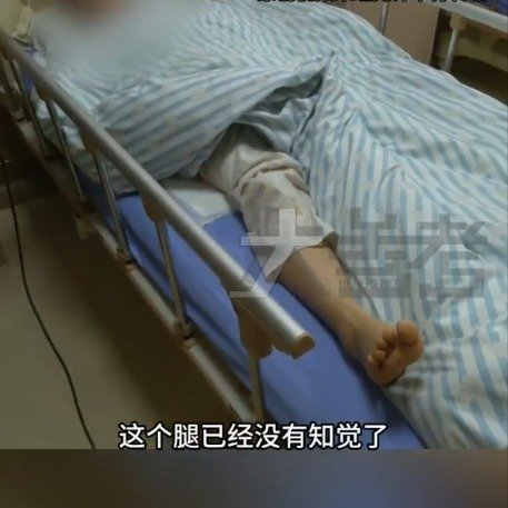 女子做完家务去按摩右腿失去知觉