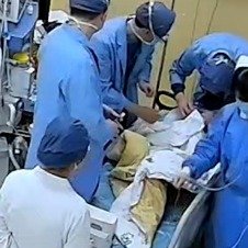 婴儿声音嘶哑就诊发现卡黄豆大异物