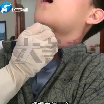 孩子爱发脾气要多去室外大喊大叫