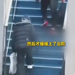 王曼昱被拍到手上提着疑似CT片子