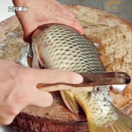 男子被鱼刺刺伤未处理感染创伤弧菌