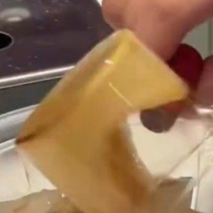 每天睡5小时喝浓咖啡小伙变暴躁两次晕倒