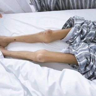 女子减肥变厌食症体重只剩40斤