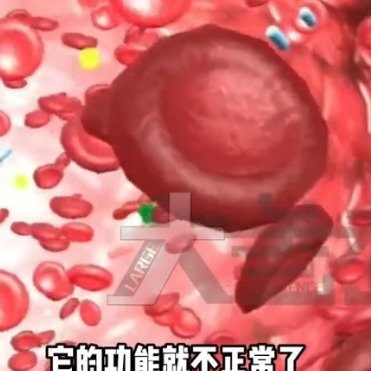 男子因妻子总抱怨长期生闷气患肺癌