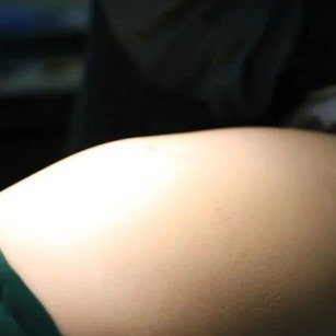 女子吃得不多但2年胖了30斤
