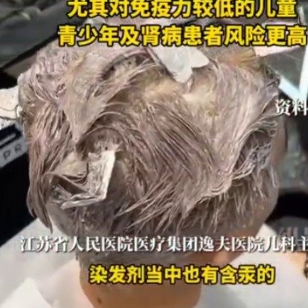 男孩半年内反复染发致肾病复发