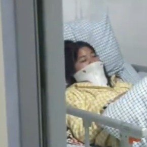 女子追尾后淡定吃烧烤隔天发现骨折
