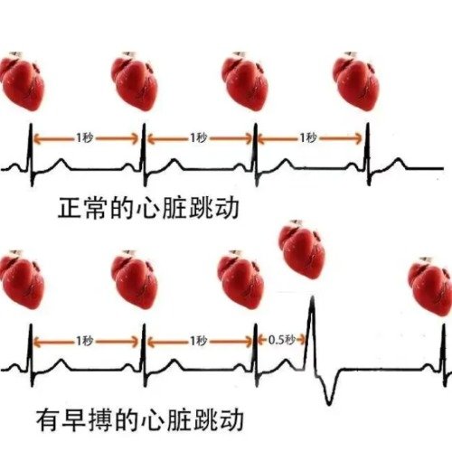 为什么心脏会突感咯噔一下
