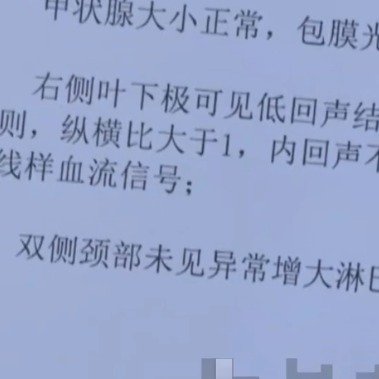 女子全职带俩娃嗓子疼查出恶性结节