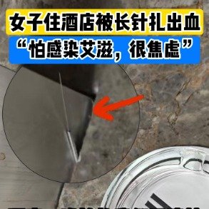 女子被酒店长针扎出血吃HIV阻断药