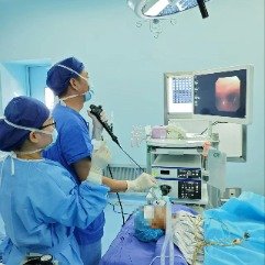 7岁儿童做雾化时咳出12厘米蚂蟥