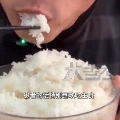 男子爱炫精致碳水查出癌症之王