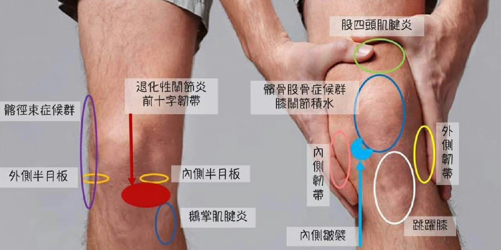 不同部位疼痛的原因找到了