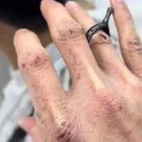 25岁理发师双手和脸不像一个人的