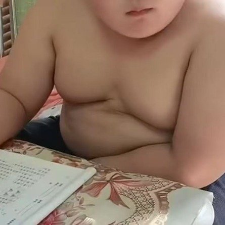 11岁男童160斤睡觉时反复呼吸暂停