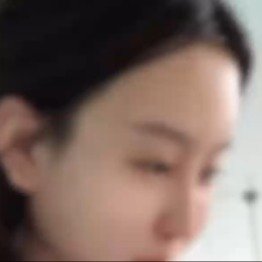 30岁女子舌苔变色意外查出卵巢癌