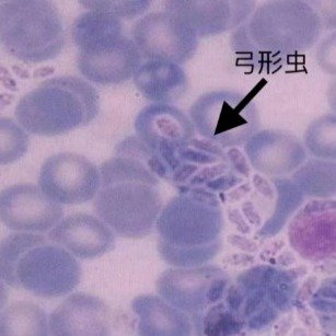 男子因喂流浪猫被弓形虫蒙上左眼
